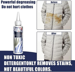 Clothes Stain Remover