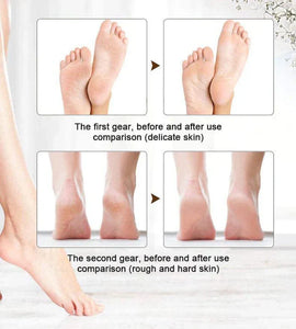 Foot File Callus Remover