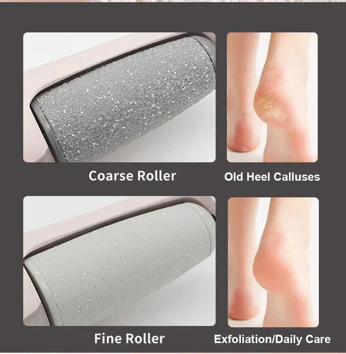 Foot File Callus Remover